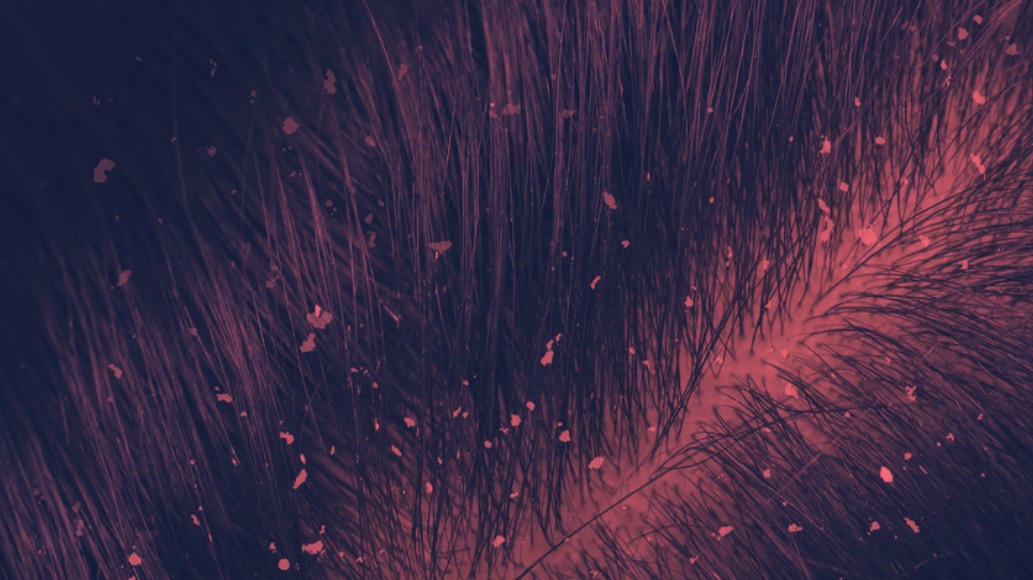 Red Light Therapy for Dandruff Relief