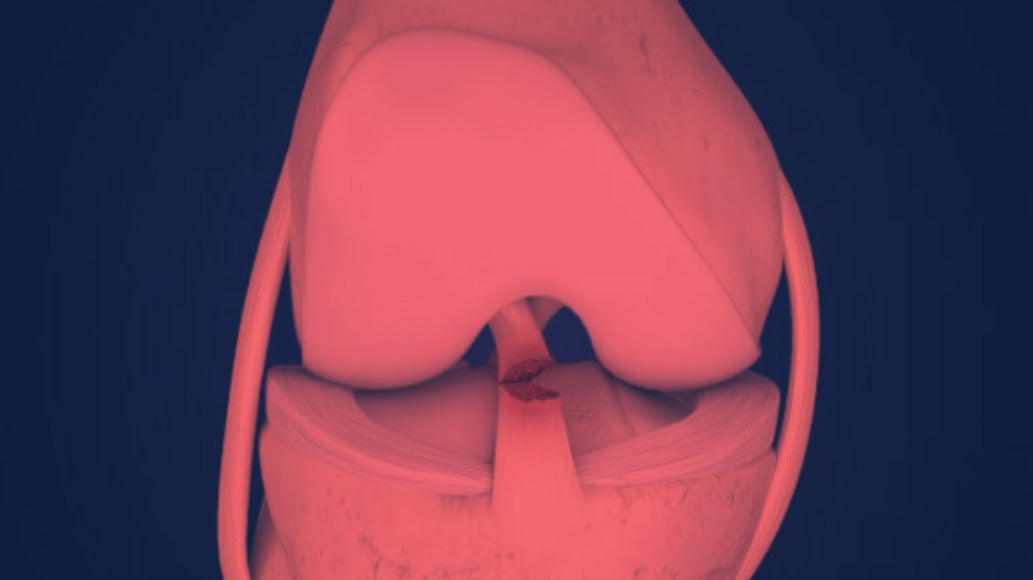 Red Light Therapy for ACL Tear