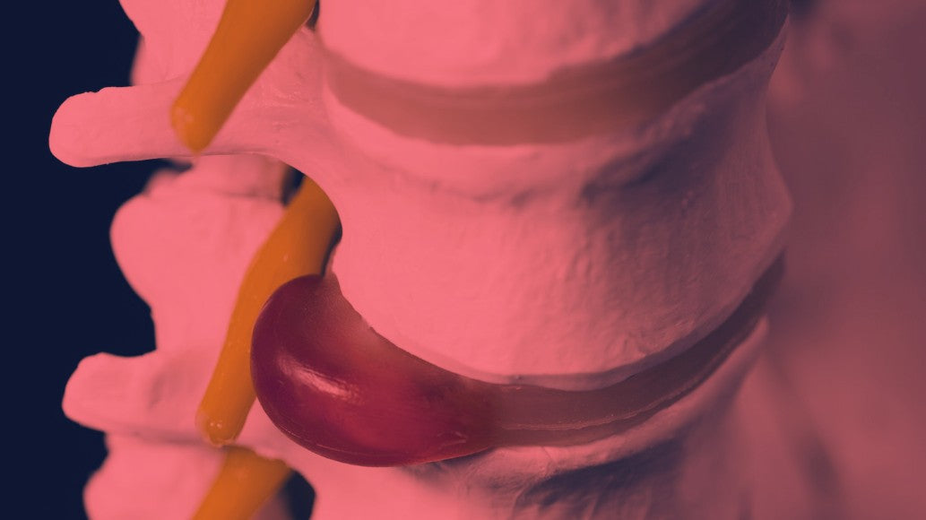 Red Light Therapy for Bulging Disc