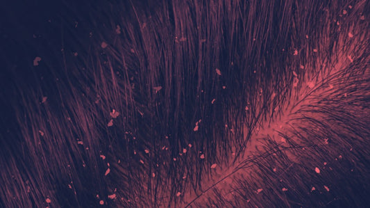 Red Light Therapy for Dandruff Relief