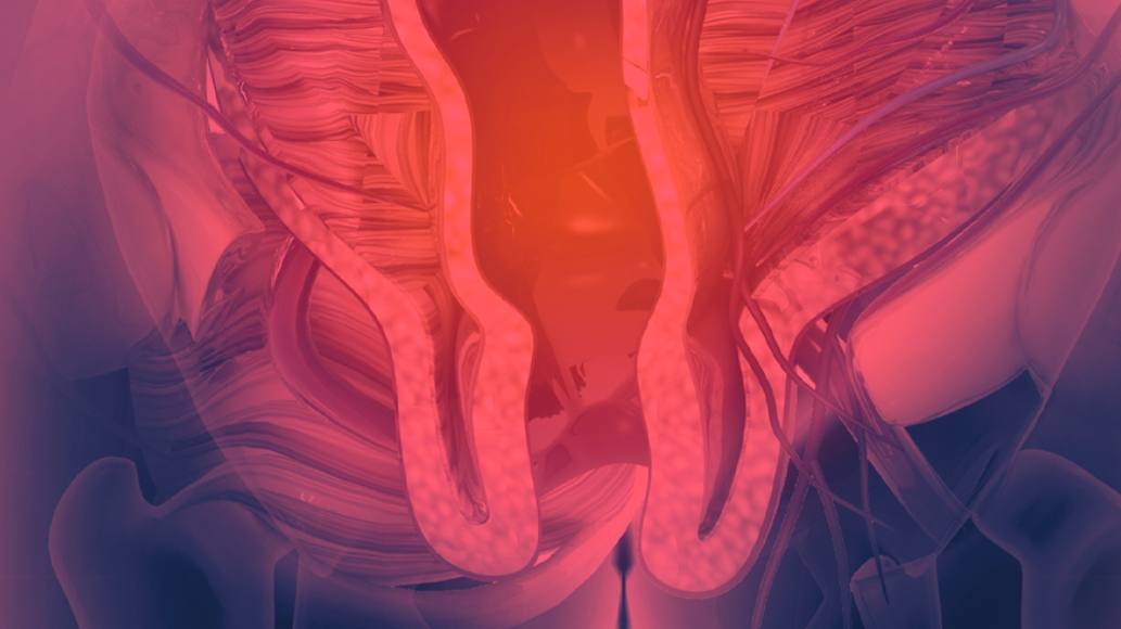 Red Light Therapy for Hemorrhoids