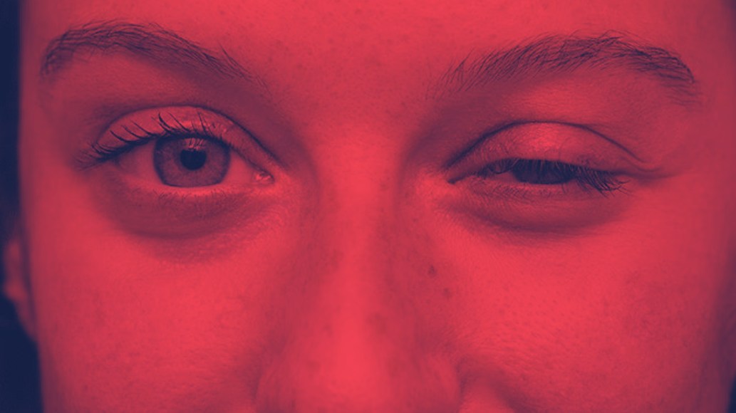 Red Light Therapy for Myasthenia Gravis