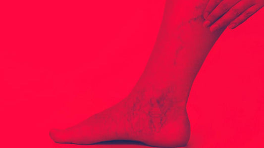 Red Light Therapy for Spider Veins