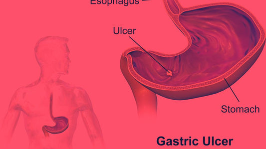 Red Light Therapy for Ulcers