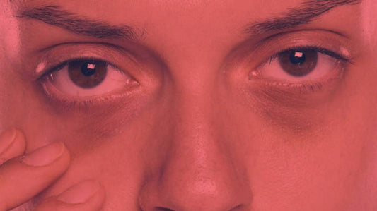 Best Light Therapy for Dark Circles