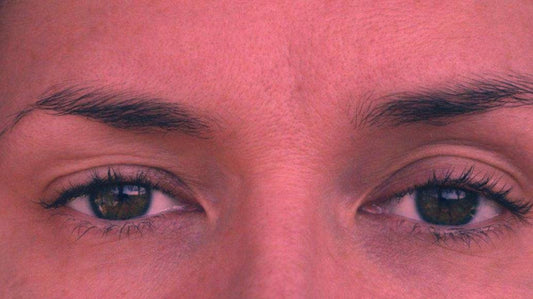 Red Light Therapy for Droopy Eyelids