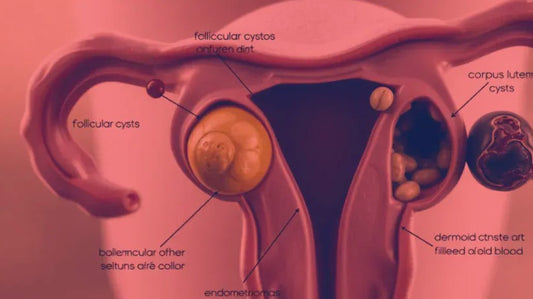 Red Light Therapy for Ovarian Cysts