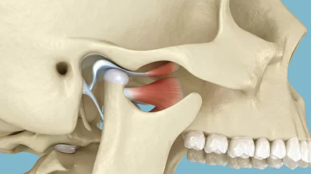 Red Light Therapy for TMJ