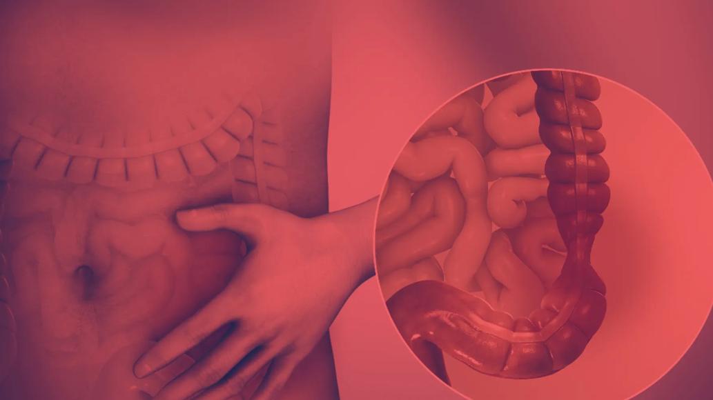 Red Light Therapy for IBS