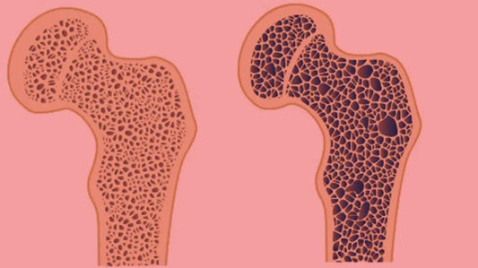 Does Red Light Therapy Increase Bone Density