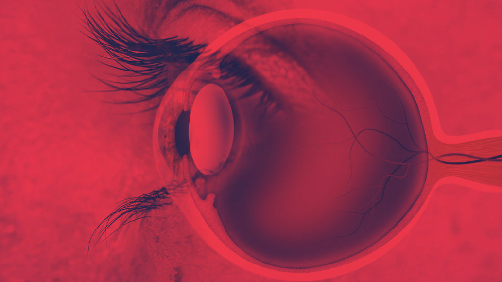 Red Light Therapy for Myopia