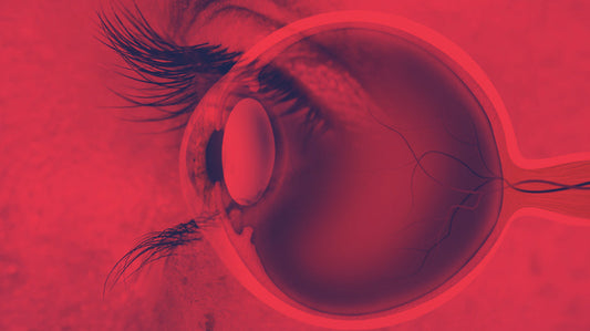 Red Light Therapy for Myopia