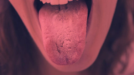 Does Red Light Therapy Kill Candida?