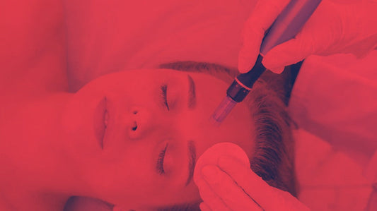Red Light Therapy After Microneedling