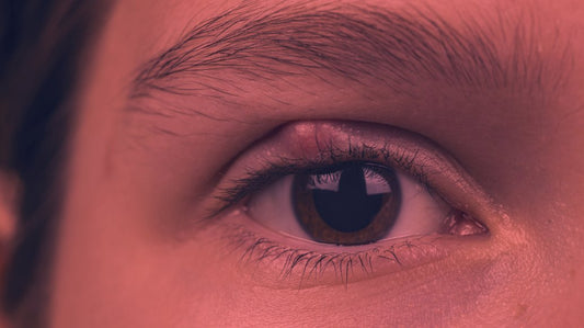 Red Light Therapy for Chalazion