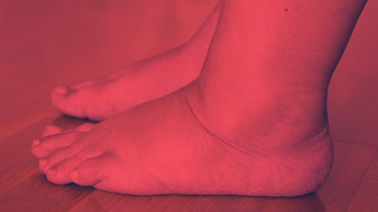 Red Light Therapy for Swollen Foot 